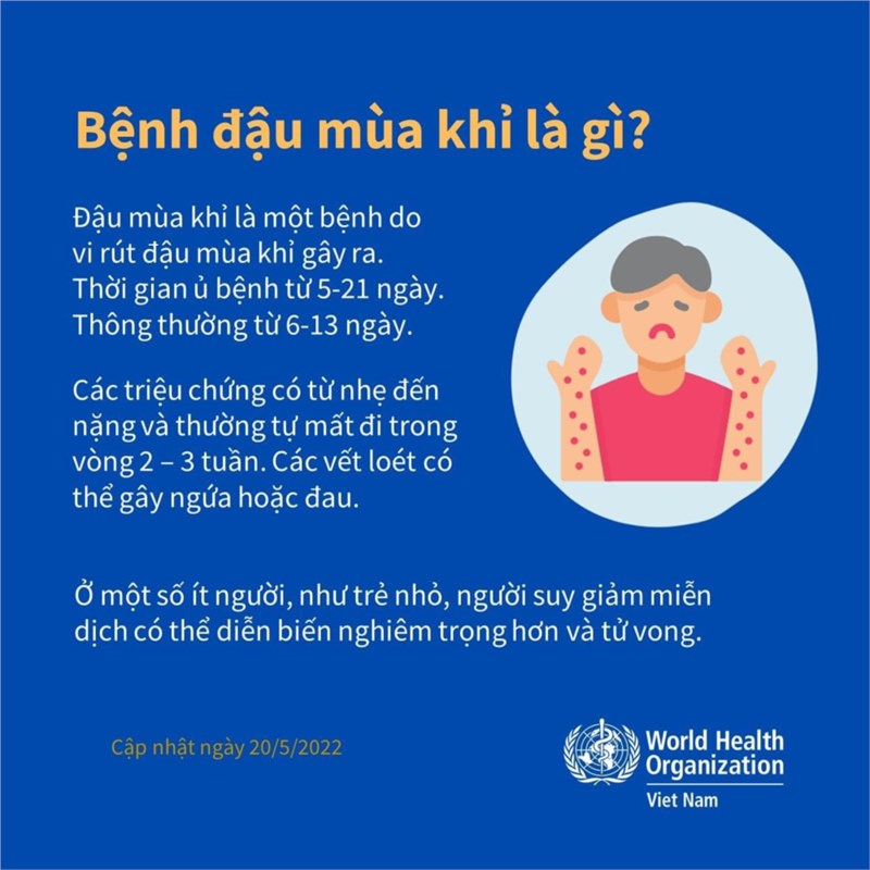 Tăng cường giám sát, phòng chống bệnh đậu mùa khỉ